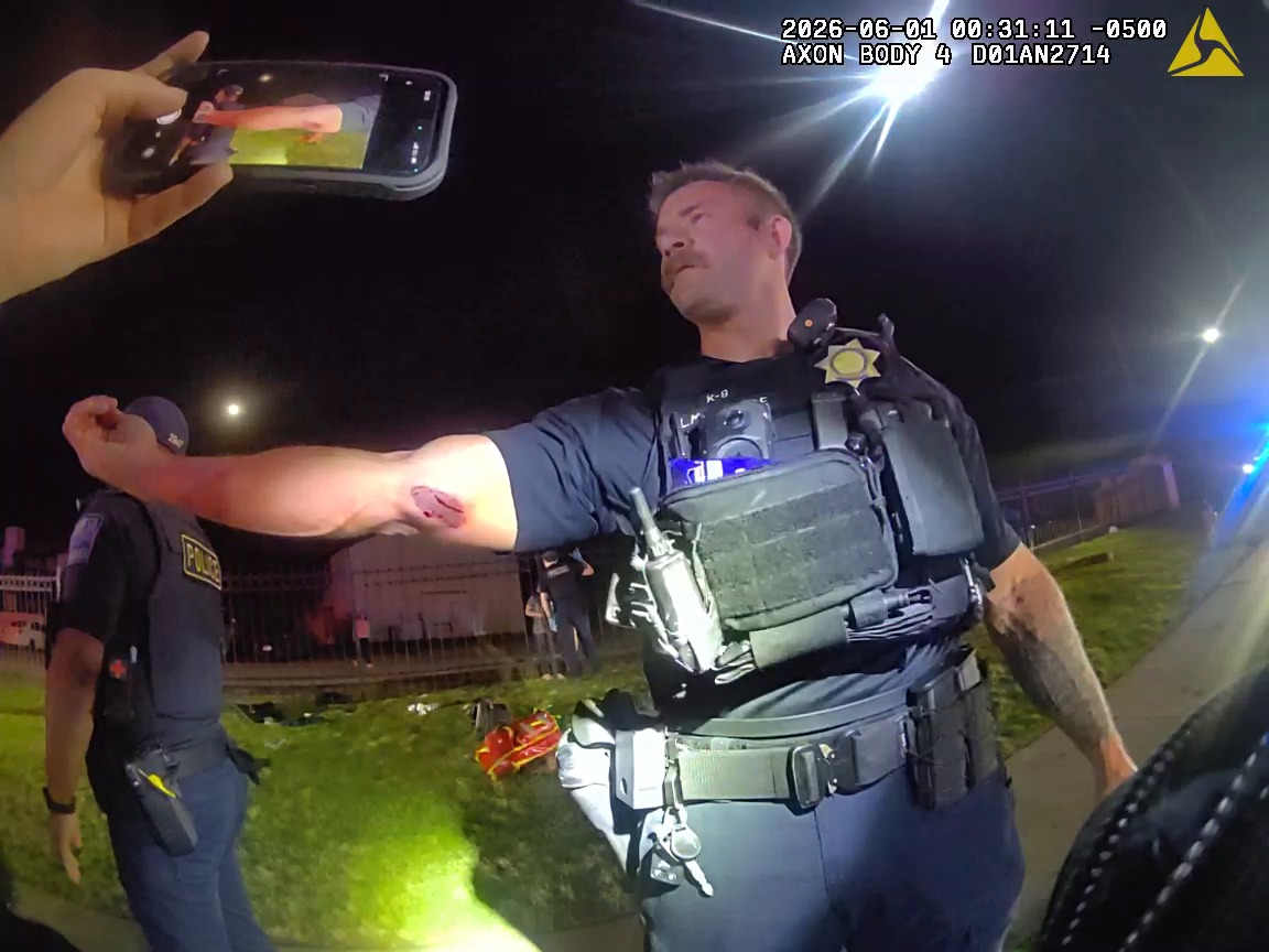 Man bites officer, punches K-9 dog, police say